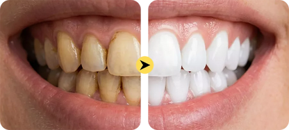 Instant Whitening Tooth Paint