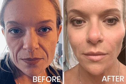 V-Face Lifting Invisible Adhesive Tape
