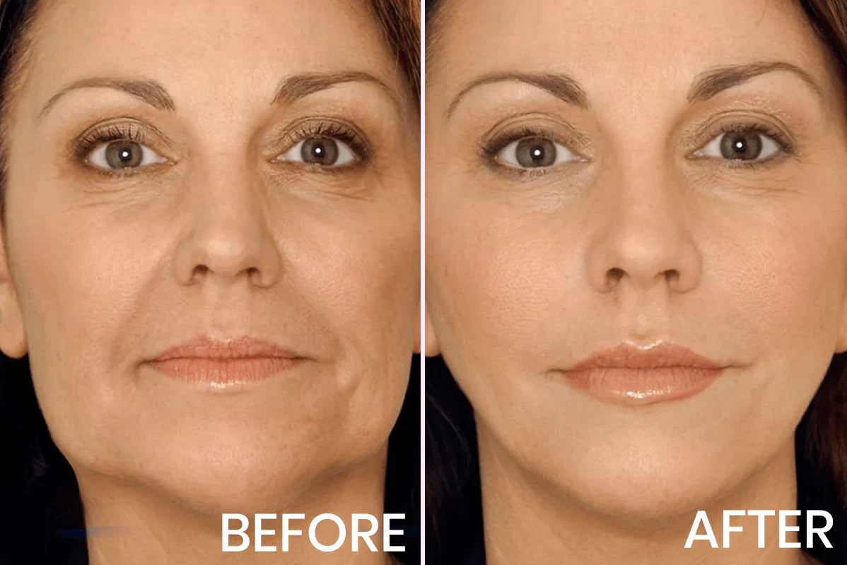 V-Face Lifting Invisible Adhesive Tape