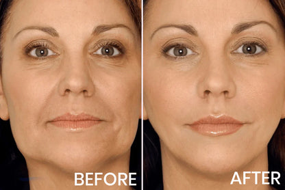 V-Face Lifting Invisible Adhesive Tape