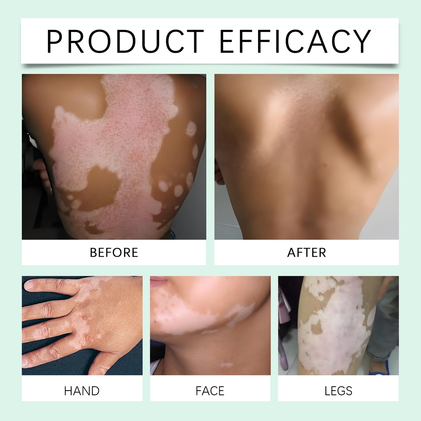 Hight Effect Herbal Aloe Vera & Mint Care Cream