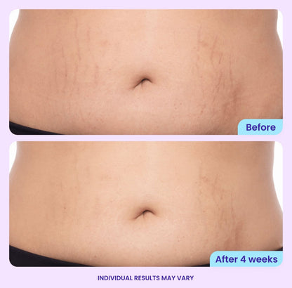 GOPURE Tighten & Smooth Belly Firming Cream