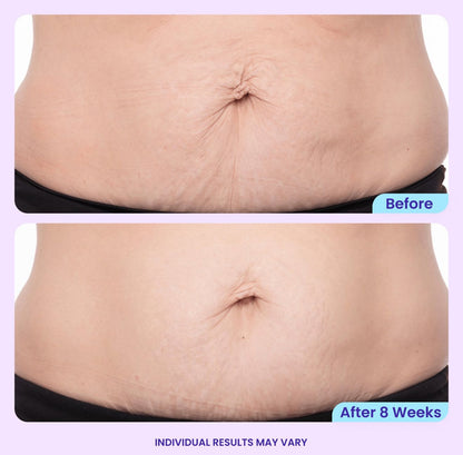 GOPURE Tighten & Smooth Belly Firming Cream