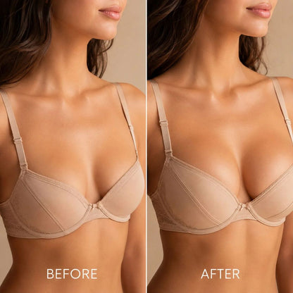 Targeted Breast Enhancement Advanced Nano Microneedle Patch