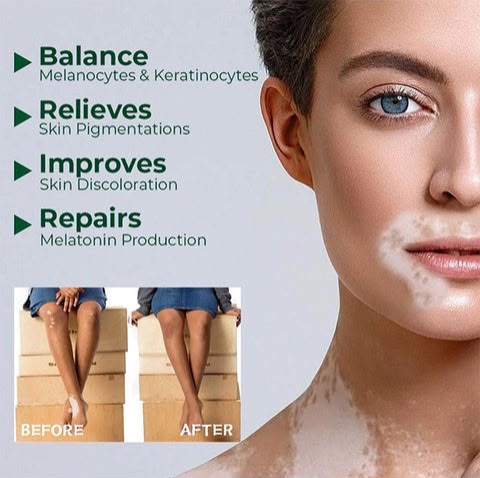 Hight Effect Herbal Aloe Vera & Mint Care Cream
