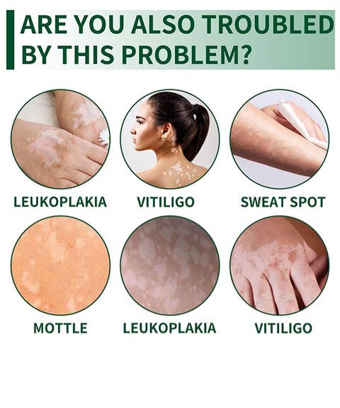 Hight Effect Herbal Aloe Vera & Mint Care Cream