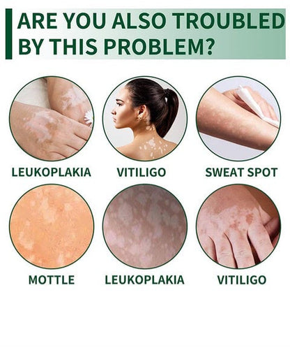 Hight Effect Herbal Aloe Vera & Mint Care Cream
