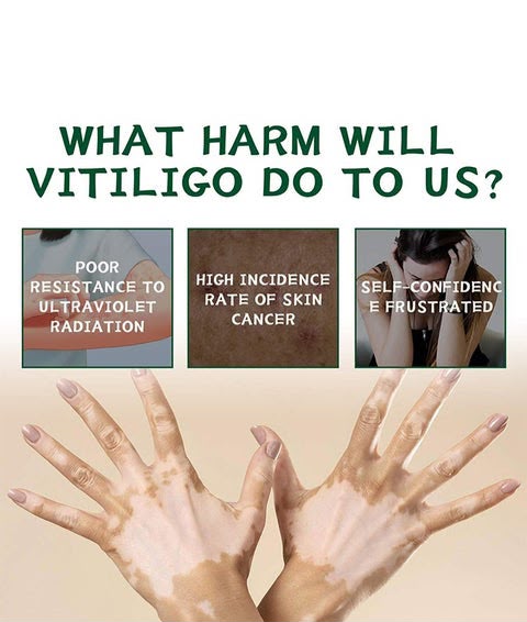 Hight Effect Herbal Aloe Vera & Mint Care Cream